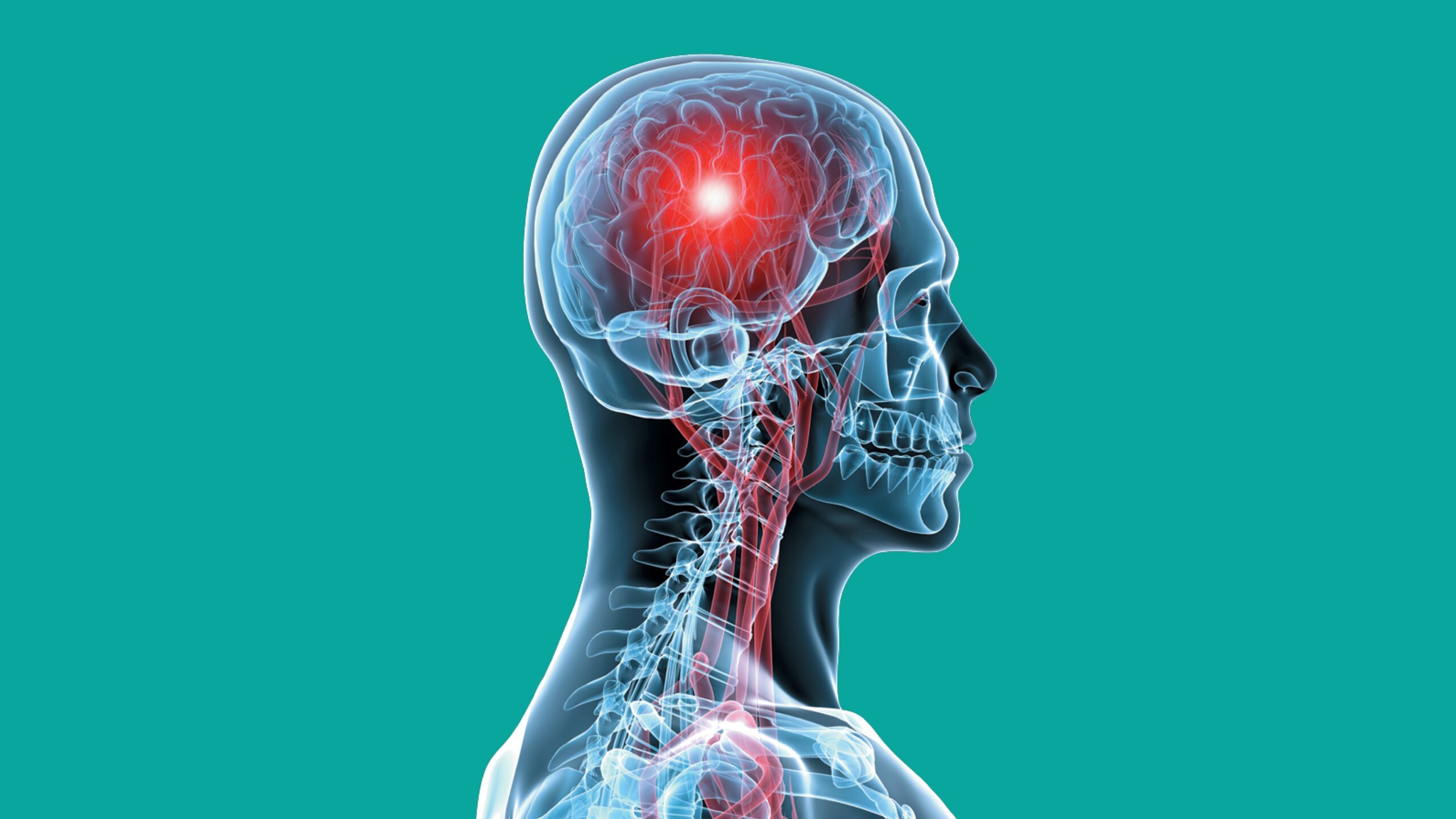 Brain Disease Types